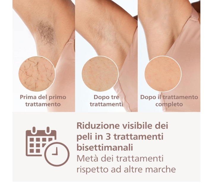 Philips Lumea BRI955 Cordless 9000 Series IPL Hair Removal